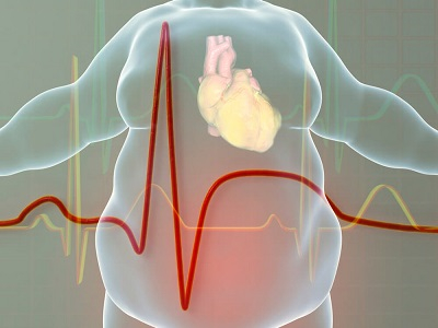 OBESIDAD: LA OTRA PANDEMIA
